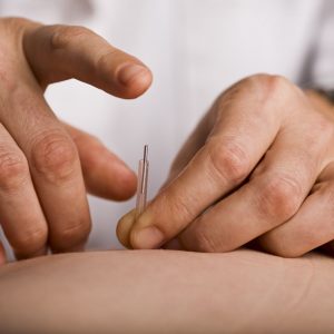 Encinitas Acupuncture
